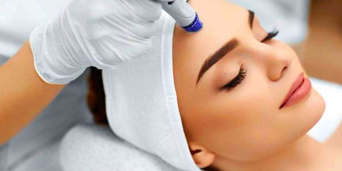 5 Benefits of Hydrafacial for Fine Lines and Wrinkles