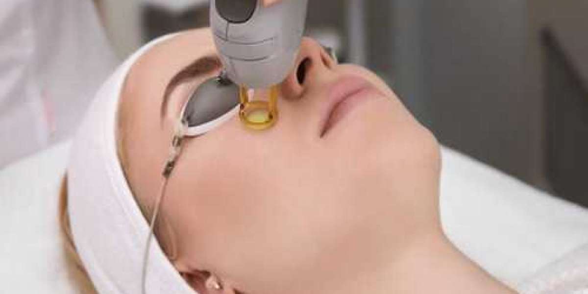 Are skin laser treatments safe for the face?