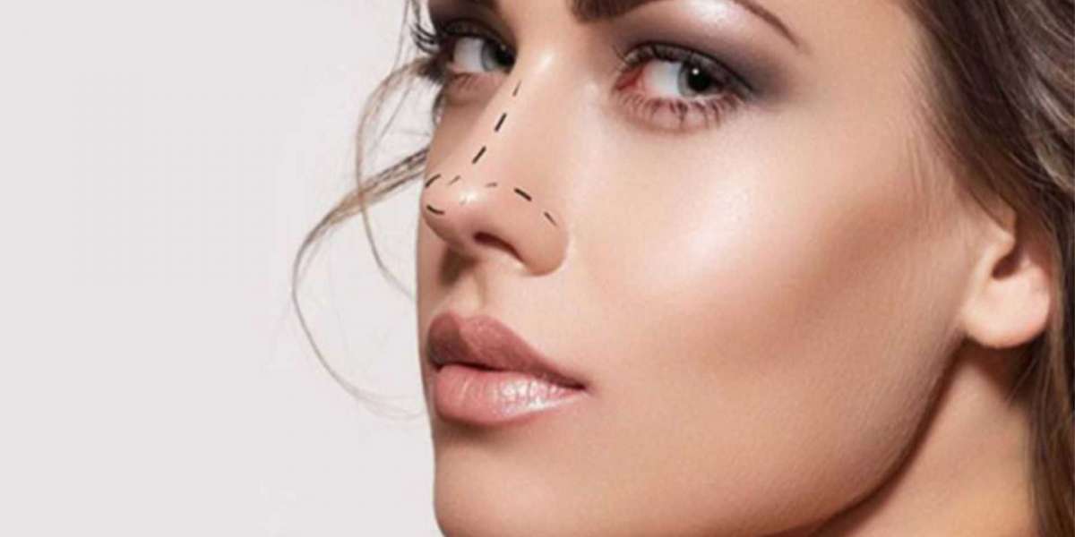 Enhance Face Aesthetics with the Help of Rhinoplasty Surgery