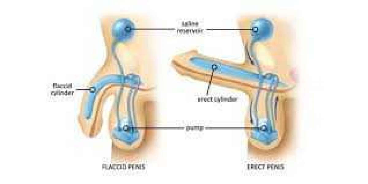 What is Premature Ejaculation?