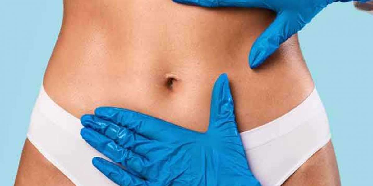 Liposuction in Faridabad : Beauty & the Cut