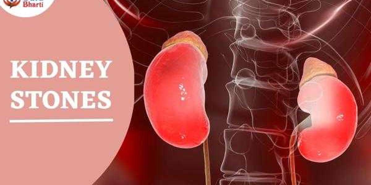 Kidney Stones : Causes, Symptoms & Treatment