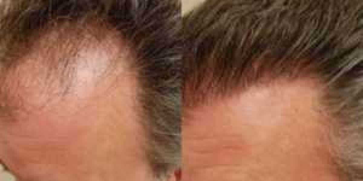 Hair transplant clinic