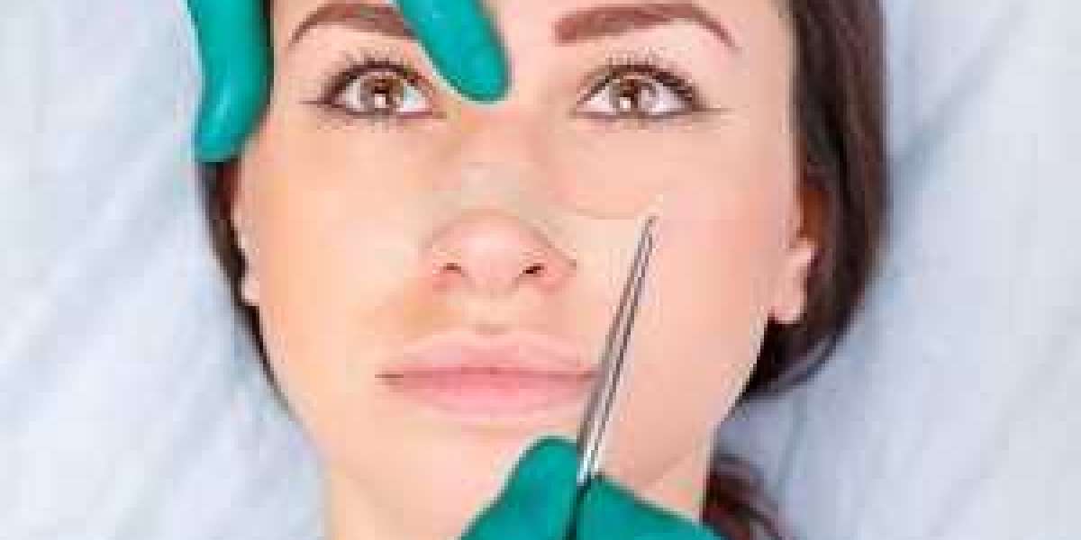 HOW TO PREPARE FOR YOUR RHINOPLASTY PROCEDURE AND RECOVERY