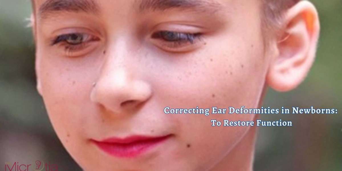 Correcting Ear Deformities in Newborns: To Restore Function