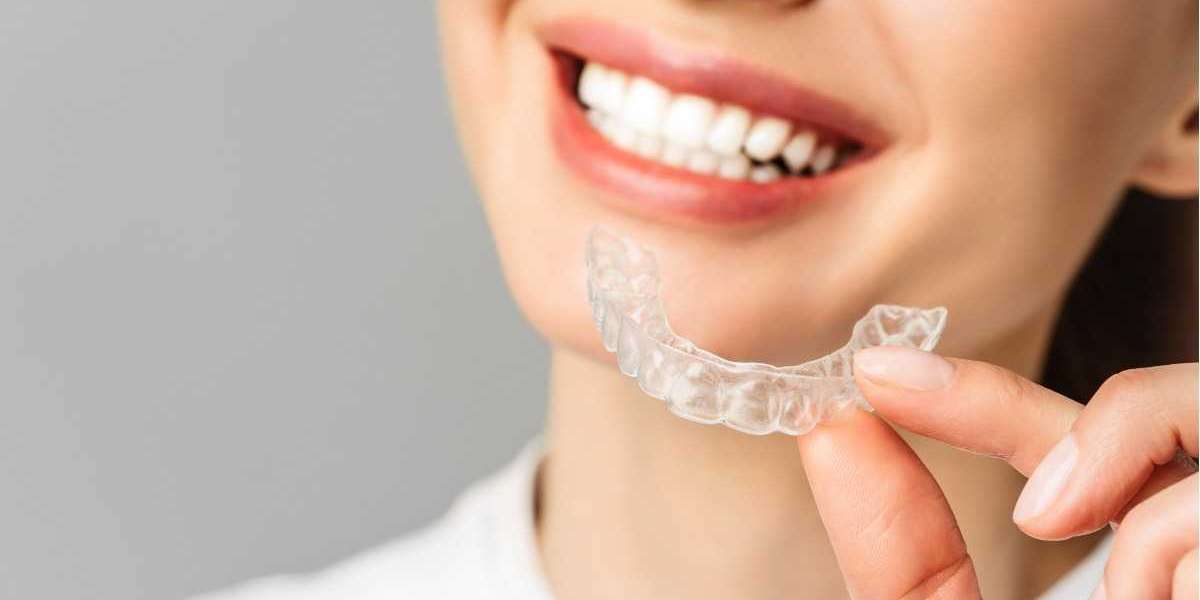 best invisalign Auckland