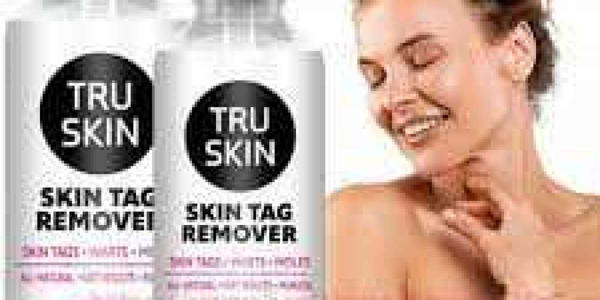 Ask Me Anything: 10 Answers to Your Questions About Tru Skin Tag Remover Review