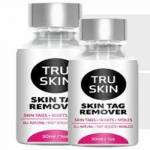 Tru Skin Tag Remover Review Profile Picture