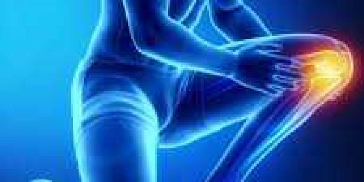 Five Things to Do Immediately for Knee Pain Relief