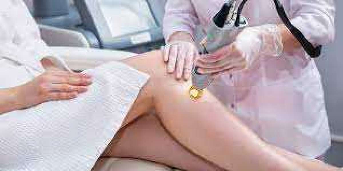 Purchase Laser Hair Removal Equipment's