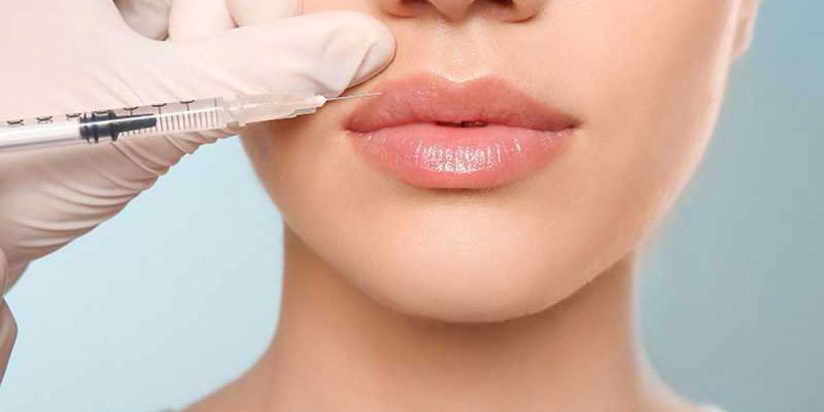 4 Areas Where Dermal Fillers Can Improve Your Face