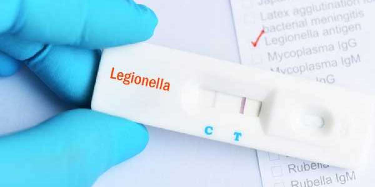 Legionella Testing is Estimated to Witness High Growth