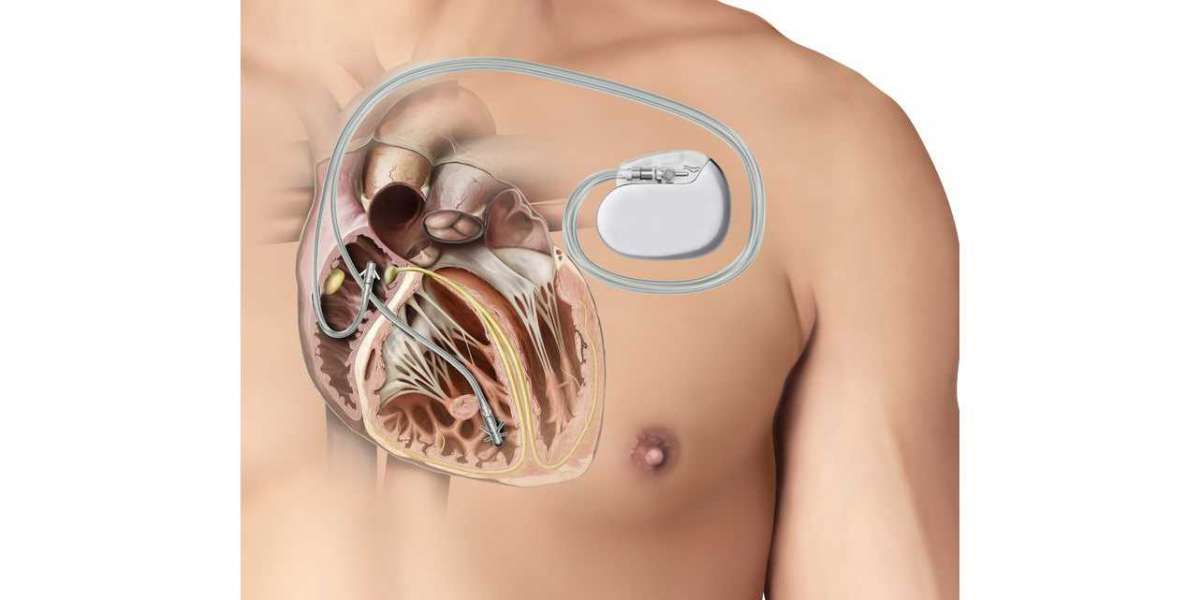 Active Implantable Medical Devices Market Analysis: Industry Dynamics
