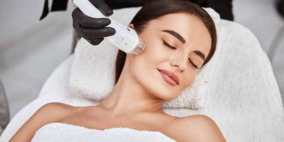 Laser Hair Removal: Smooth, Lasting Results