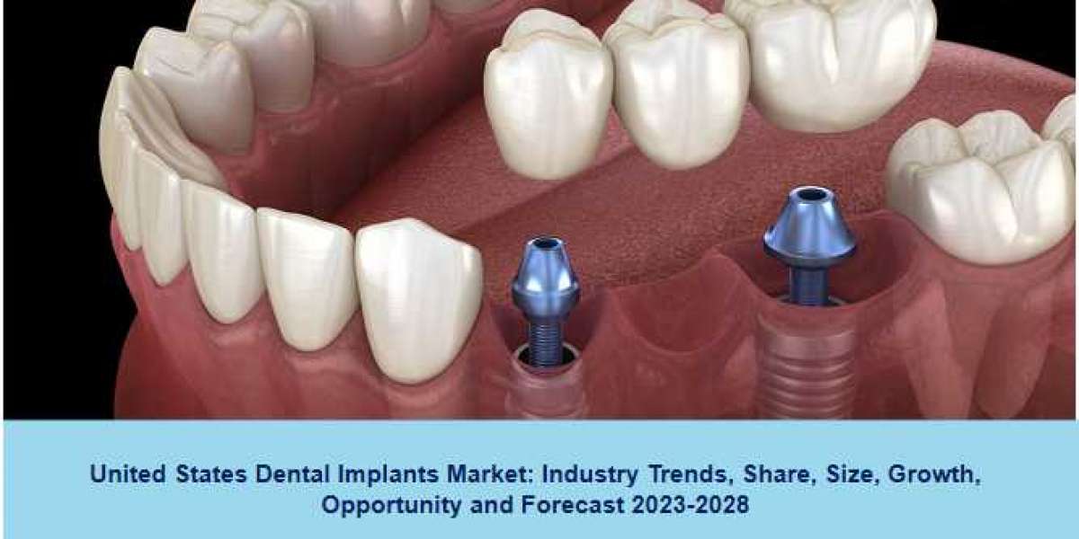 United States Dental Implants Market Trends | Growth Report 2023-28