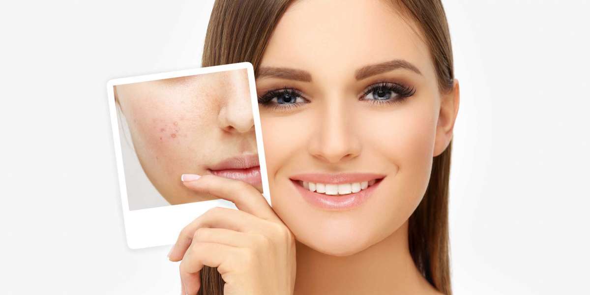 Serenity Skin Care: Premier Dermatologists in Dubai