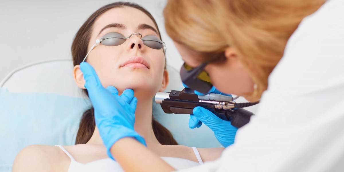 Innovative Elegance: Skin Laser Treatment in Langley