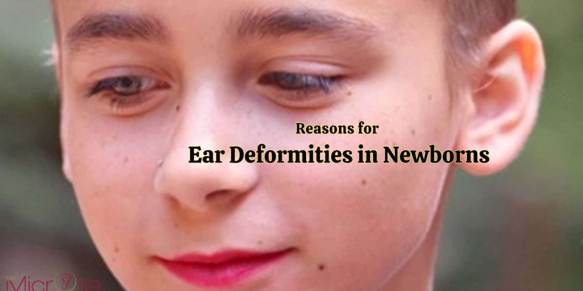 Reasons for Ear Deformities in Newborns