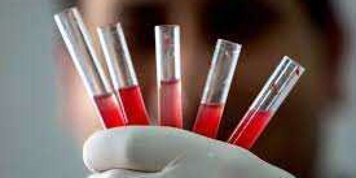 Global Blood Transfusion Diagnostics Market Size, Share, Growth Report 2030