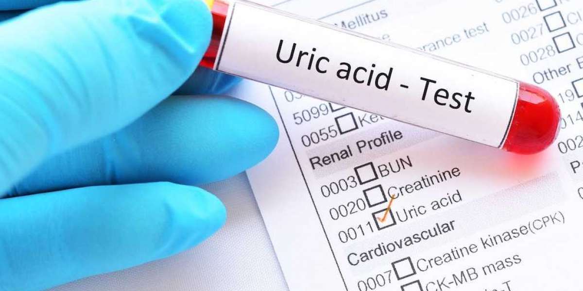 Balancing Act: The Importance of the Uric Acid Test in Monitoring Health