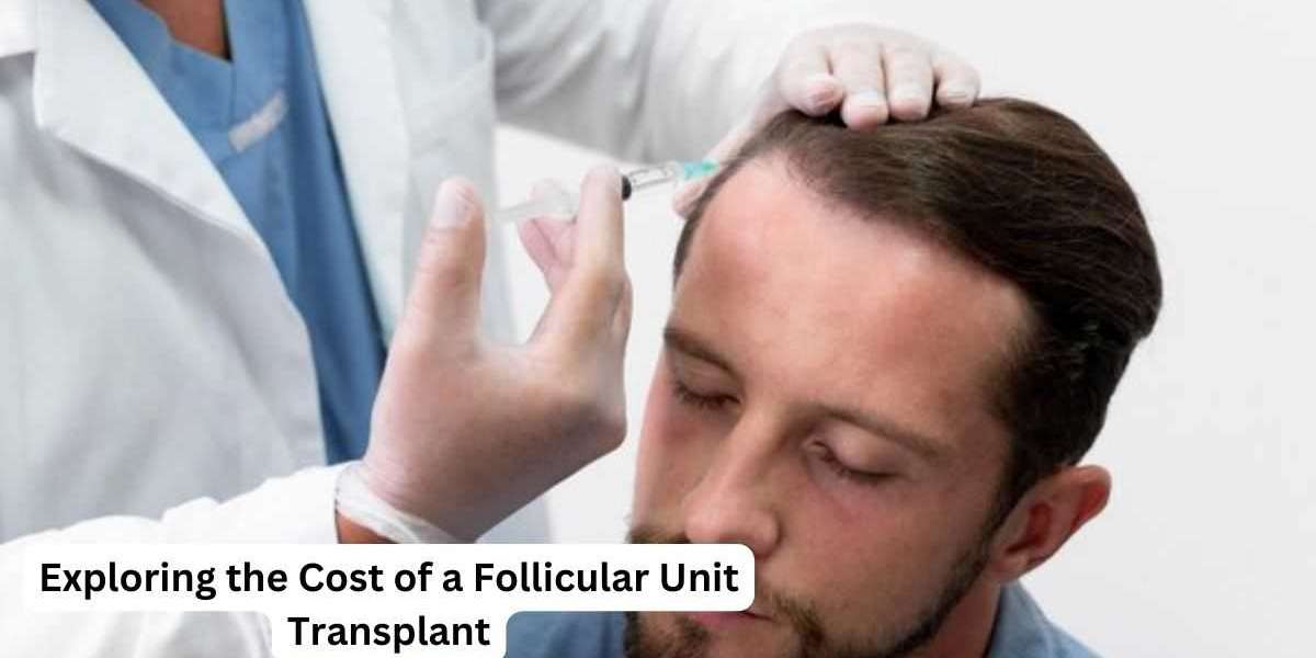 Exploring the Cost of a Follicular Unit Transplant