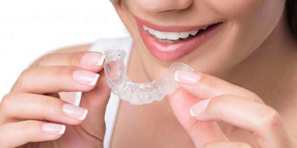 Best dental implants in Chandigarh