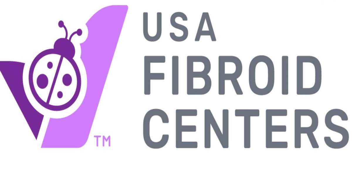 Fibroid treatment options