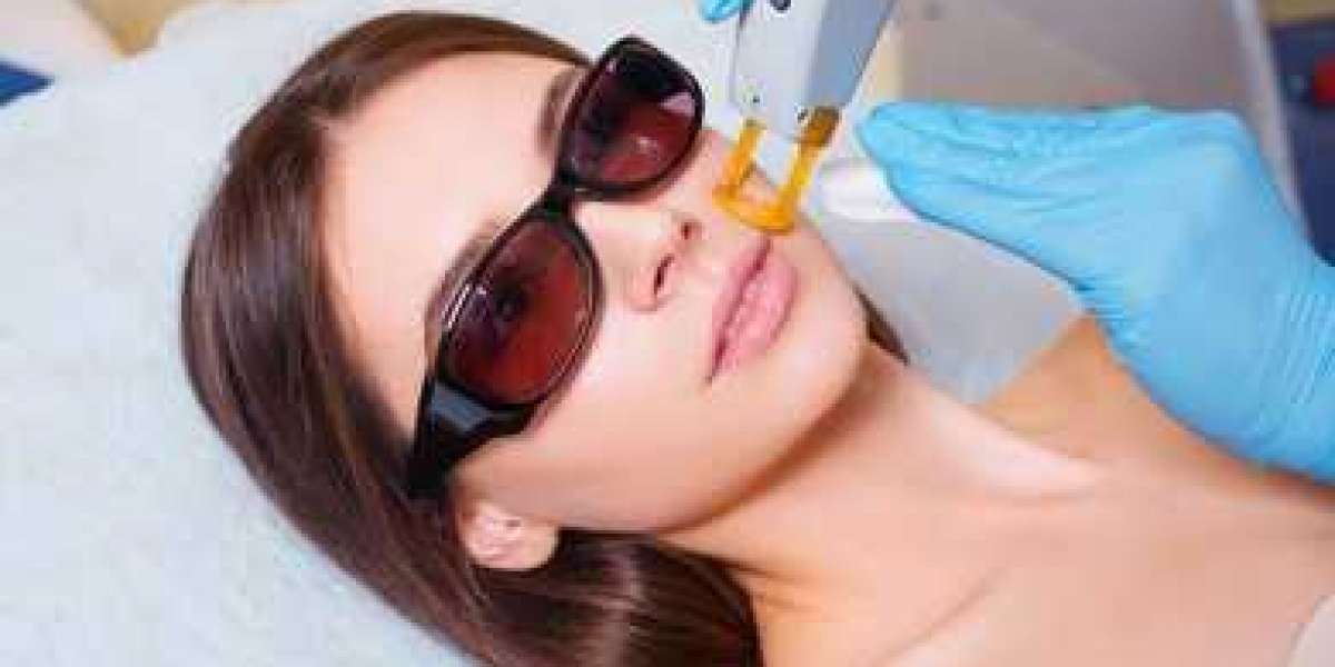 IPL Laser Hair Removal: The Ultimate Guide