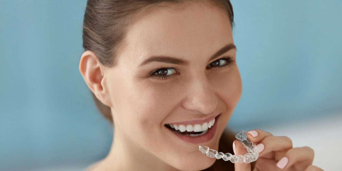 Teeth Alignment Trends: Exploring the Latest Options for Straightening Your Smile