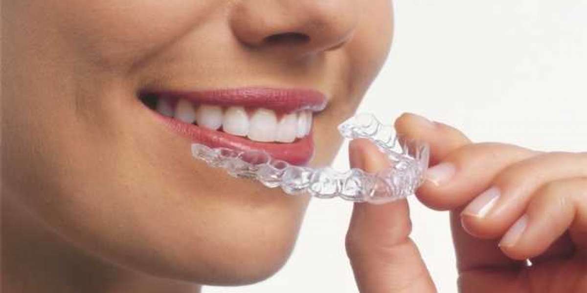 Advantages Of Choosing Invisalign Near Me From An Orthodontist In Miami, Fl