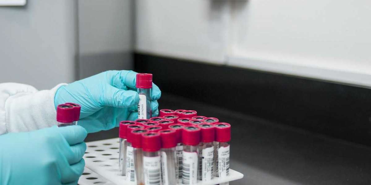 Blood Testing Market 2023 Overview, Growth Forecast, Demand and Development Research Report to 2031