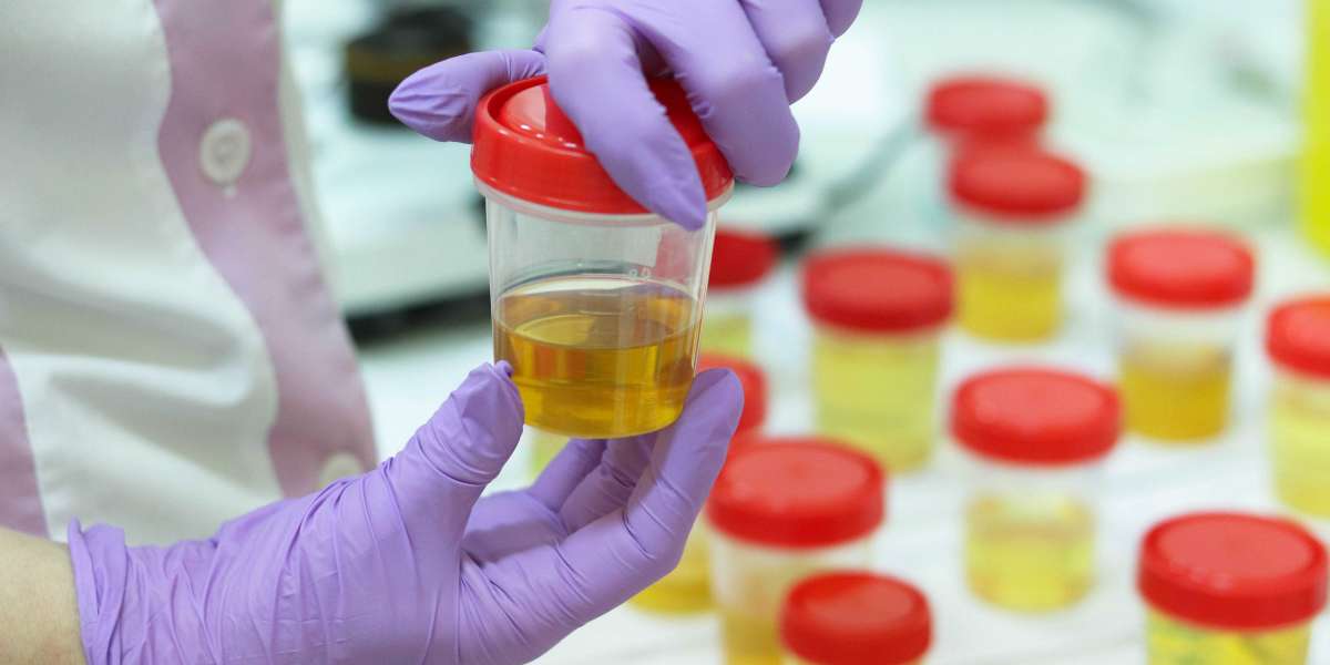 Urinalysis Industry: Know the Drivers and Barriers Of Urinalysis Market for 2024