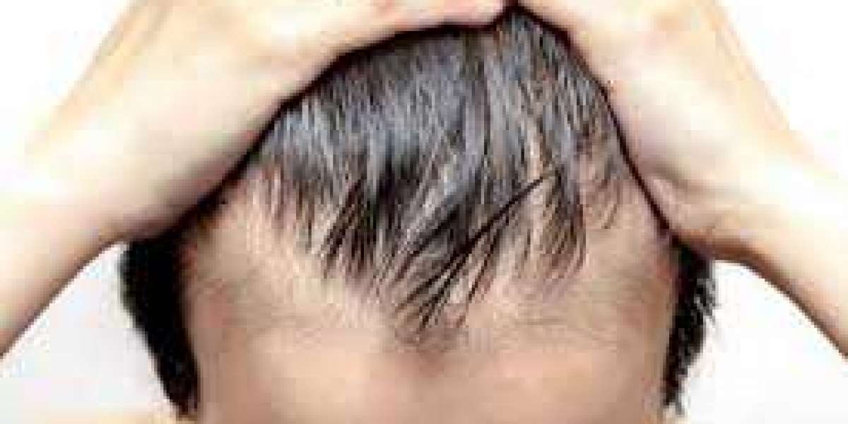 CAN A HAIR TRANSPLANT CAUSE FOLLICULITIS?