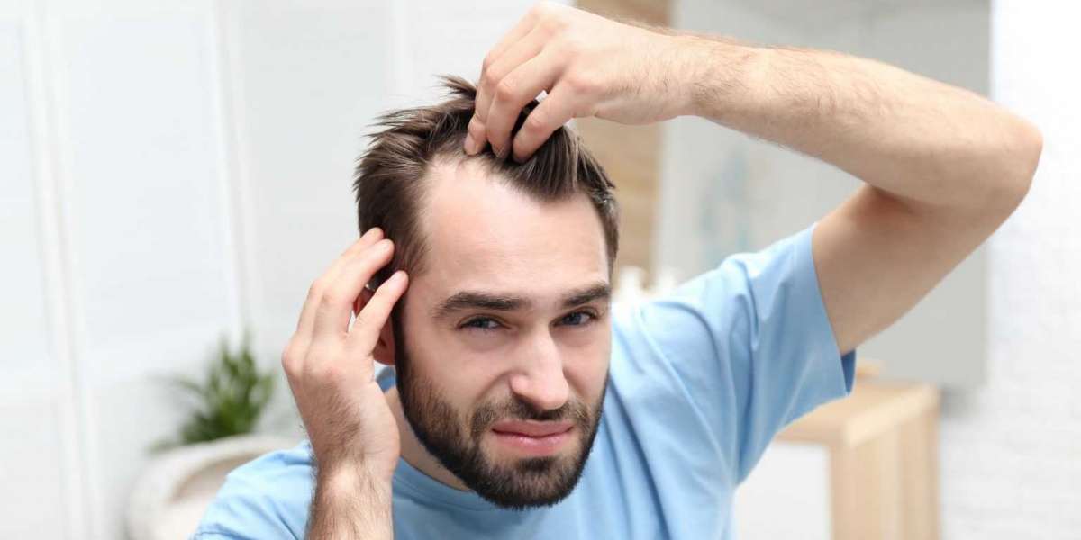 Can Stress Cause Hair Loss?