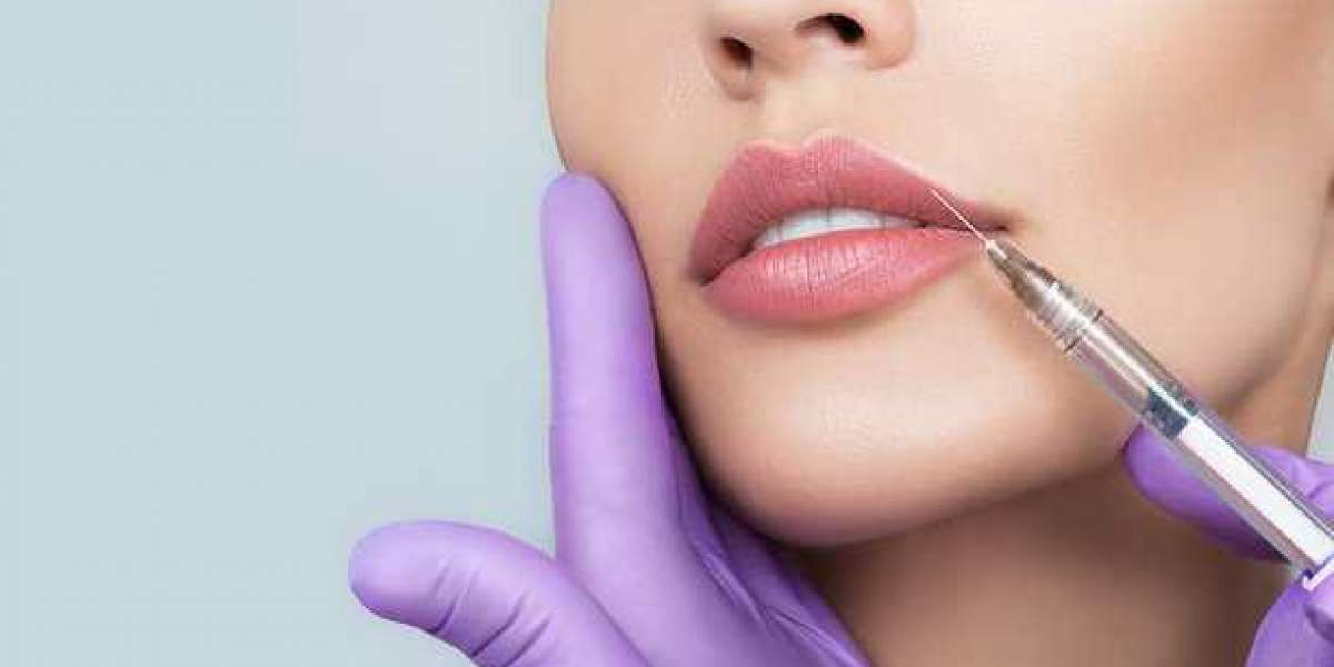 The Cost of Lip Fillers in Islamabad: What to Expect