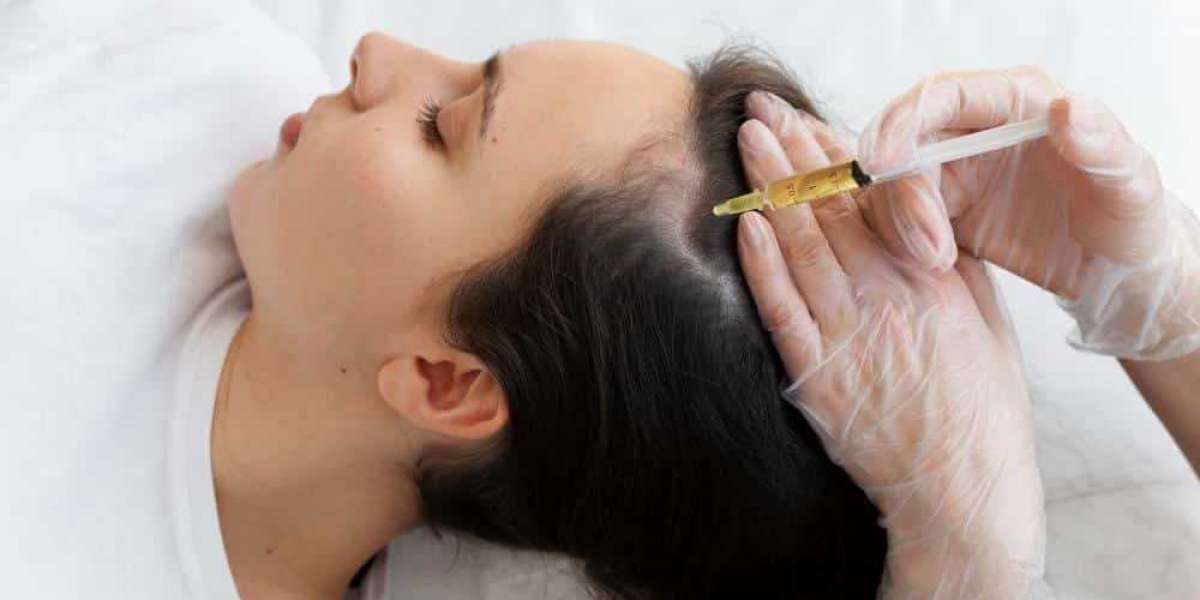 "What Are the Side Effects of PRP Hair Treatment?"