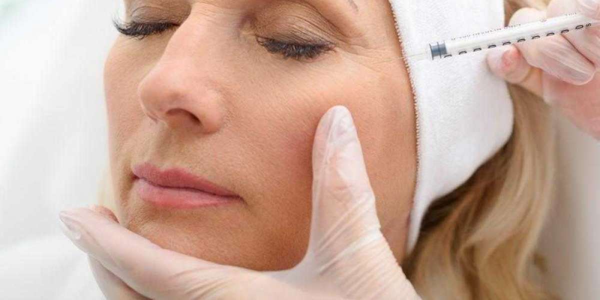 "Understanding Botox Units: How Much Do You Need?"