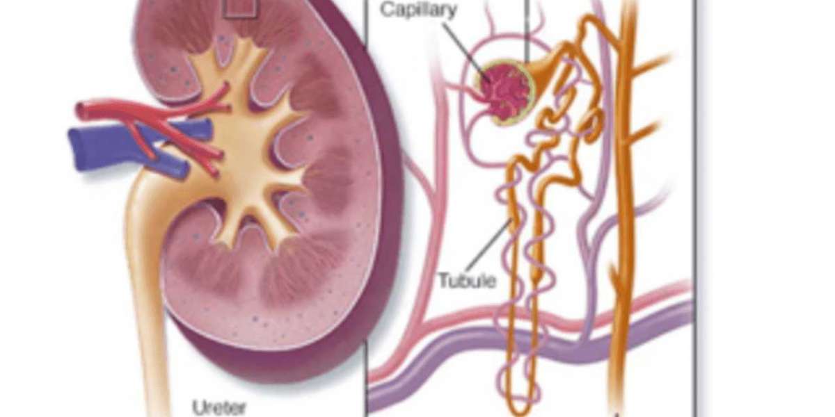 What are the treatments for acute kidney injury?