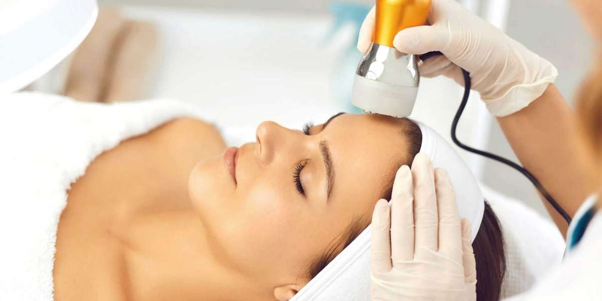 How Many Laser Skin Tightening Sessions Are Needed for Best Results?