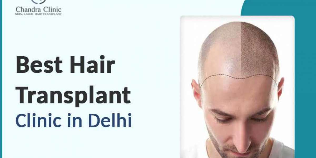 What Factors Influence the Cost of Hair Transplant Surgery?