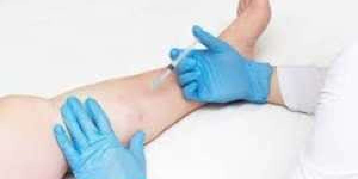 Understanding Vein Health: When to Consult a Vein Doctor