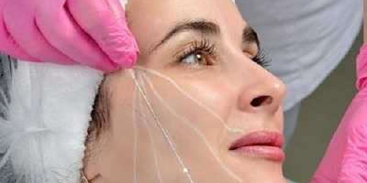 How Long Do Thread Lift Results Last in Islamabad?