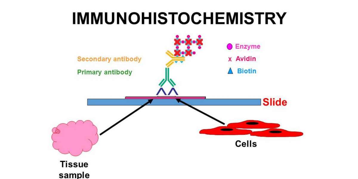 Immunohistochemistry Market Latest Trends and Analysis, Future Growth Study by 2034